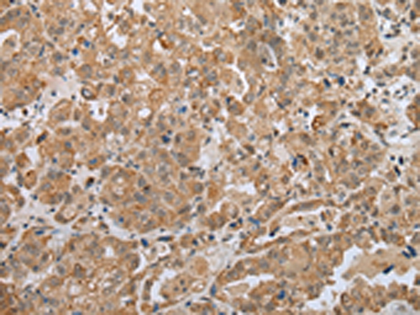 Anti-FAM3D Rabbit Polyclonal Antibody