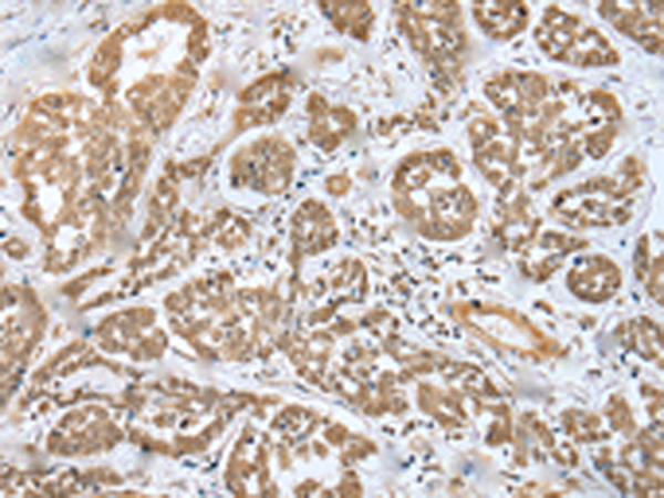 Anti-MOB4 Rabbit Polyclonal Antibody
