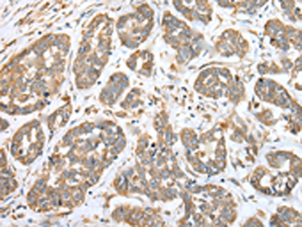 Anti-ATP6V1E2 Rabbit Polyclonal Antibody