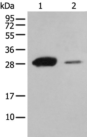 Anti-ATP6V1E2 Rabbit Polyclonal Antibody
