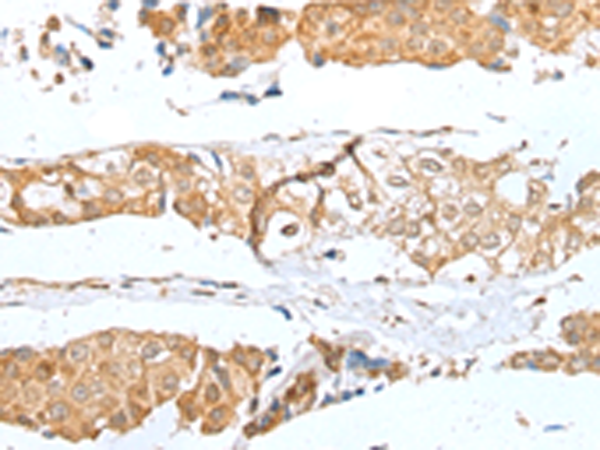 Anti-GLIPR1L1 Rabbit Polyclonal Antibody