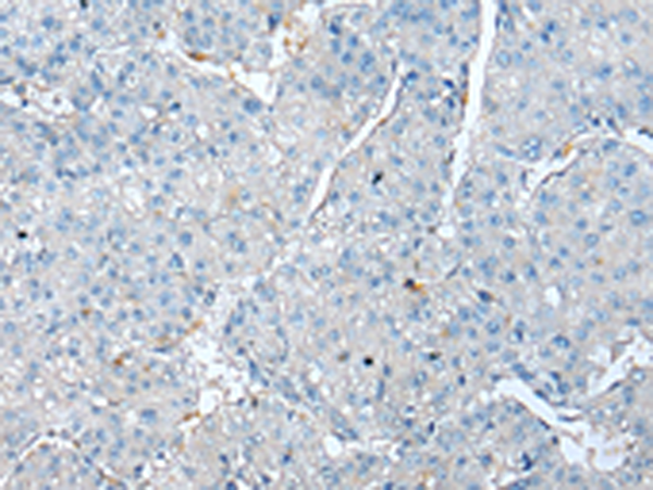Anti-TPM4 Rabbit Polyclonal Antibody