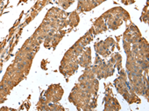 Anti-ASB9 Rabbit Polyclonal Antibody