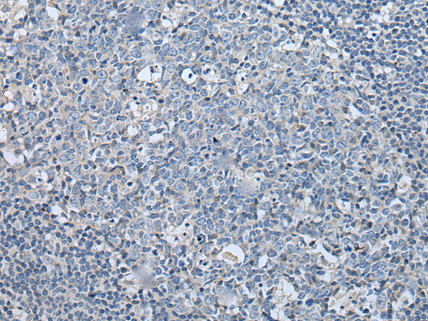 Anti-LASP1 Rabbit Polyclonal Antibody