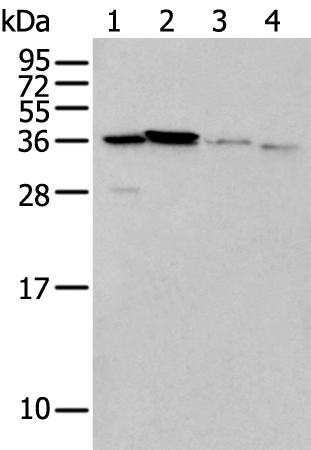 Anti-LASP1 Rabbit Polyclonal Antibody
