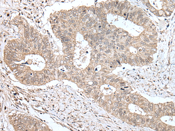 Anti-ZNF131 Rabbit Polyclonal Antibody