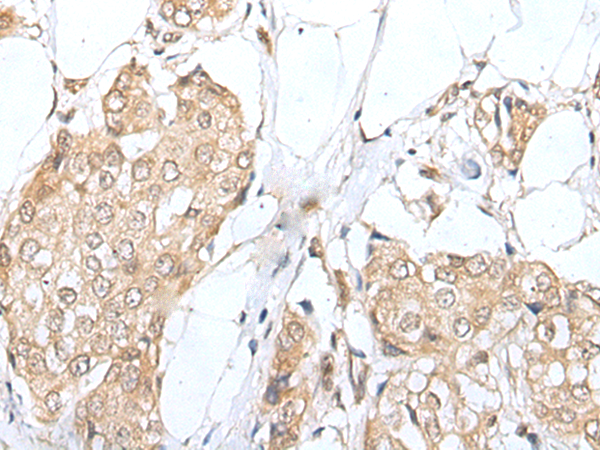 Anti-ZNF263 Rabbit Polyclonal Antibody