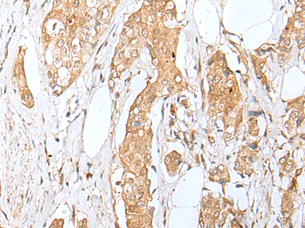 Anti-ZNF34 Rabbit Polyclonal Antibody