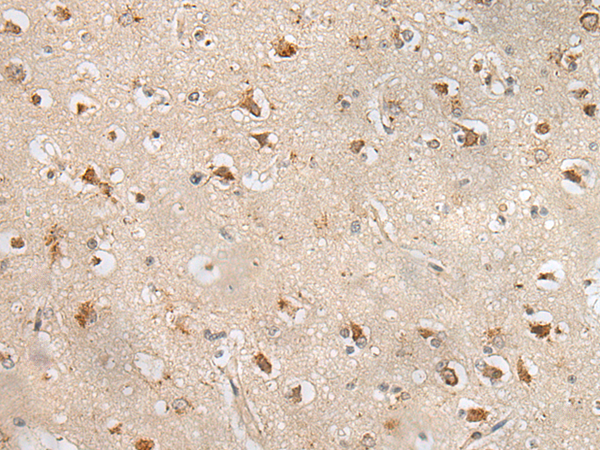 Anti-ZPBP Rabbit Polyclonal Antibody