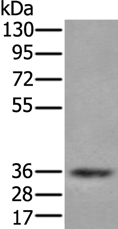 Anti-ZPBP Rabbit Polyclonal Antibody