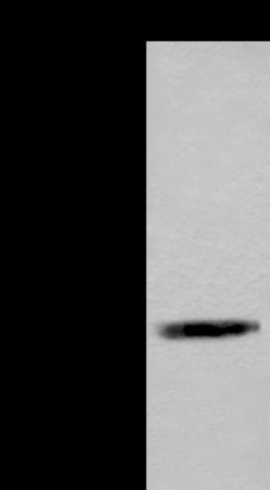 Anti-ACAT2 Rabbit Polyclonal Antibody