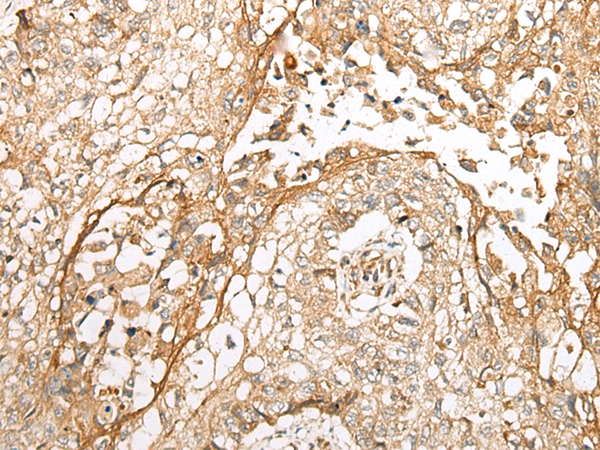 Anti-WBP1 Rabbit Polyclonal Antibody