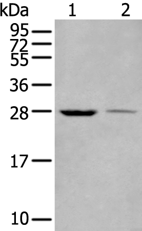 Anti-WBP1 Rabbit Polyclonal Antibody