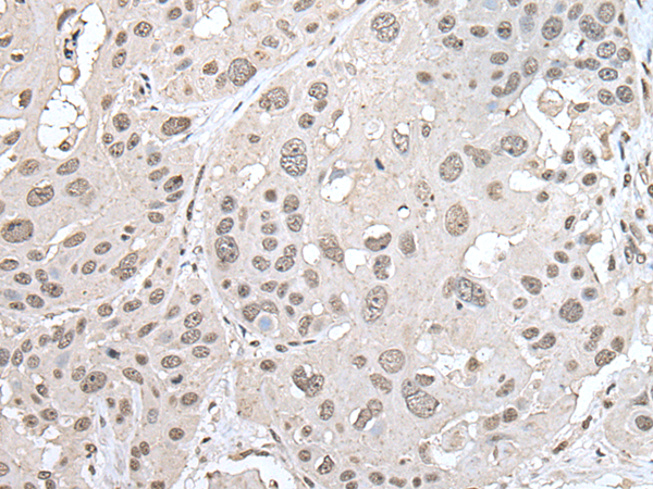 Anti-VRK1 Rabbit Polyclonal Antibody