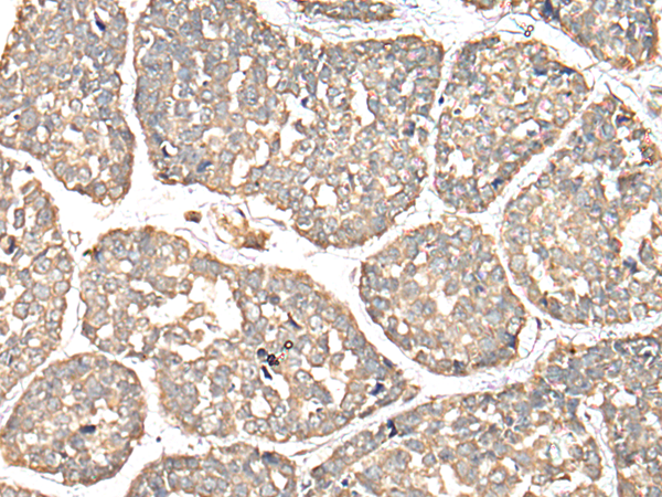 Anti-VTI1A Rabbit Polyclonal Antibody