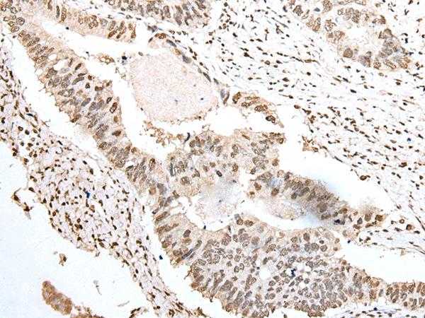 Anti-U1A Rabbit Polyclonal Antibody
