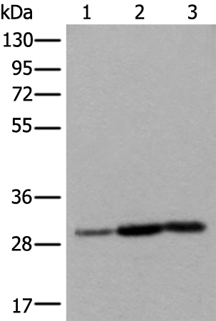Anti-U1A Rabbit Polyclonal Antibody