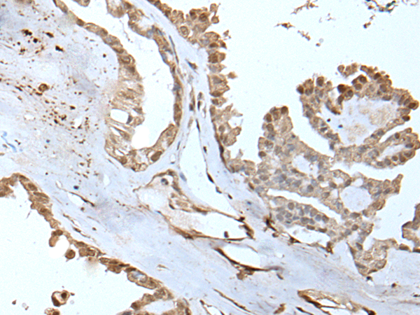 Anti-U2AF2 Rabbit Polyclonal Antibody