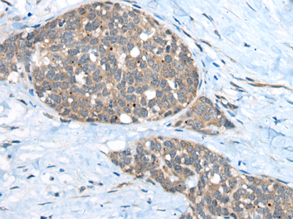 Anti-Ubiquitin Conjugating Enzyme E2 G2 Rabbit Polyclonal Antibody