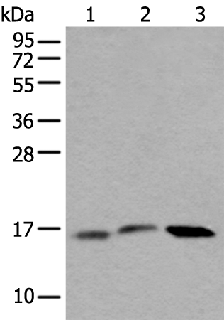 Anti-Ubiquitin Conjugating Enzyme E2 G2 Rabbit Polyclonal Antibody