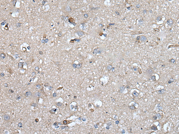 Anti-UMPS Rabbit Polyclonal Antibody
