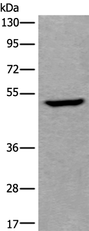 Anti-UMPS Rabbit Polyclonal Antibody