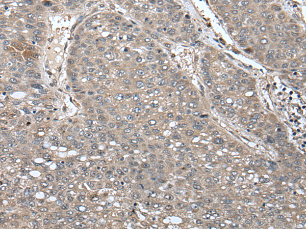 Anti-UNC45B Rabbit Polyclonal Antibody