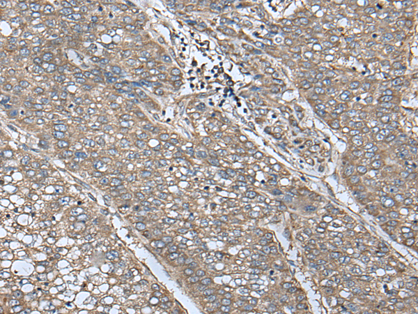 Anti-Complex III Subunit 8 Rabbit Polyclonal Antibody