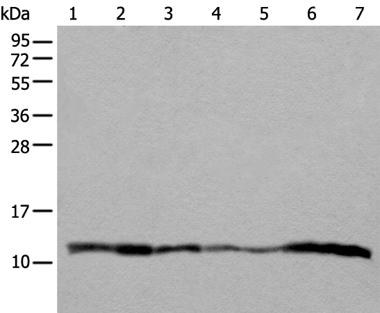 Anti-Complex III Subunit 8 Rabbit Polyclonal Antibody