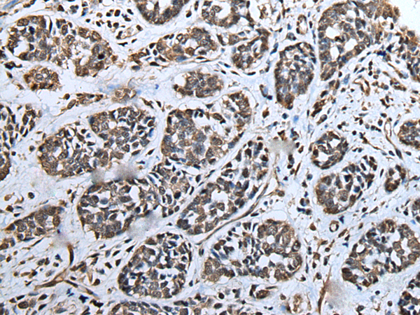 Anti-ATAD1 Rabbit Polyclonal Antibody