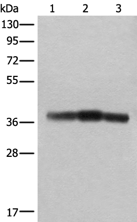 Anti-ATAD1 Rabbit Polyclonal Antibody