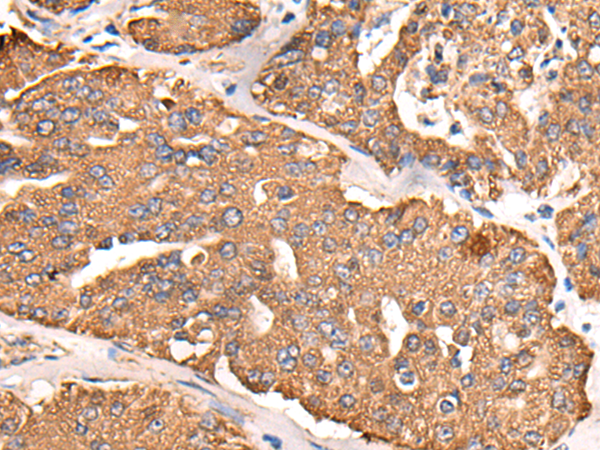 Anti-ATP5F1C Rabbit Polyclonal Antibody