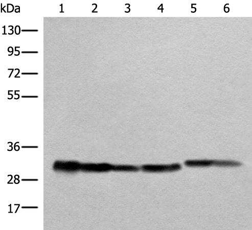 Anti-ATP5F1C Rabbit Polyclonal Antibody