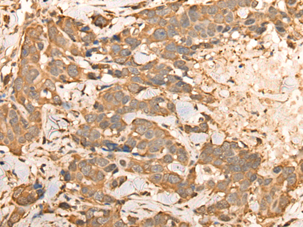 Anti-BAIAP2L1 Rabbit Polyclonal Antibody
