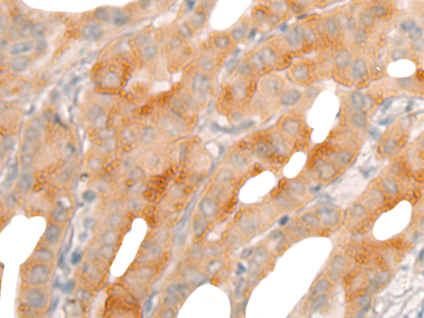 Anti-BBOX1 Rabbit Polyclonal Antibody