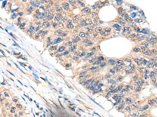 Anti-BHMT2 Rabbit Polyclonal Antibody