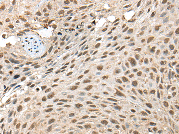 Anti-TIMM21 Rabbit Polyclonal Antibody