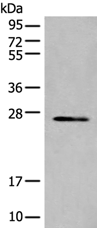 Anti-TIMM21 Rabbit Polyclonal Antibody
