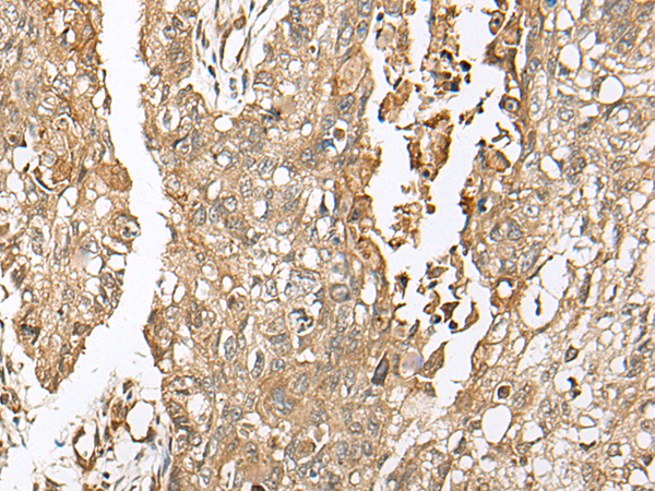 Anti-COA7 Rabbit Polyclonal Antibody