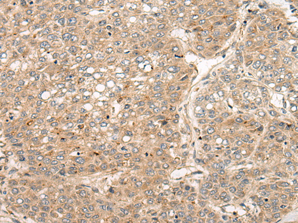 Anti-C1orf93 Rabbit Polyclonal Antibody