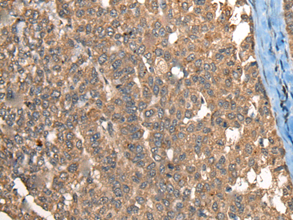 Anti-C1R Rabbit Polyclonal Antibody