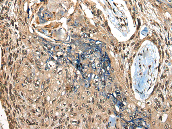 Anti-CAMKK1 Rabbit Polyclonal Antibody
