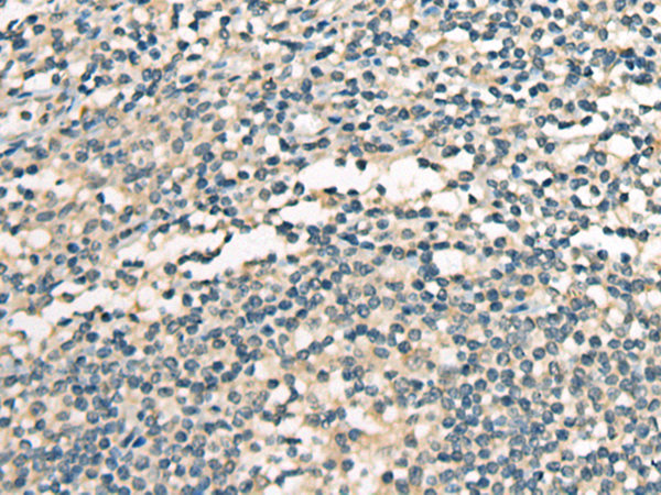 Anti-Caspr2 Rabbit Polyclonal Antibody