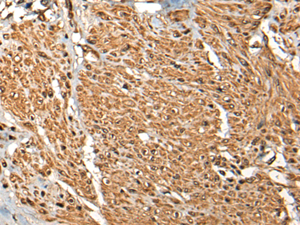 Anti-MICU1 Rabbit Polyclonal Antibody