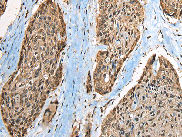 Anti-CCDC137 Rabbit Polyclonal Antibody