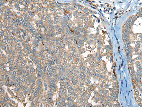 Anti-CCT6b Rabbit Polyclonal Antibody