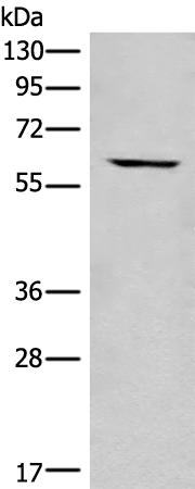 Anti-CCT6b Rabbit Polyclonal Antibody
