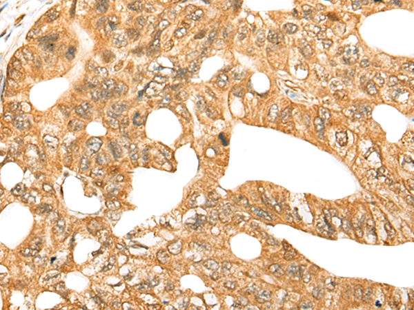 Anti-CDCA4 Rabbit Polyclonal Antibody