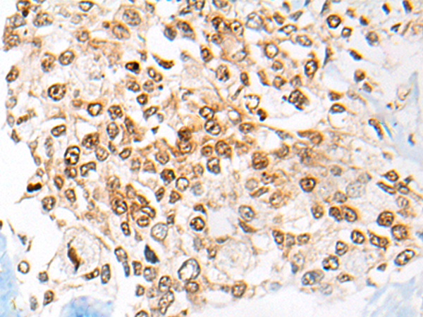 Anti-CETN3 Rabbit Polyclonal Antibody