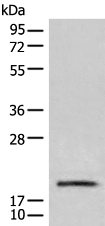 Anti-CETN3 Rabbit Polyclonal Antibody